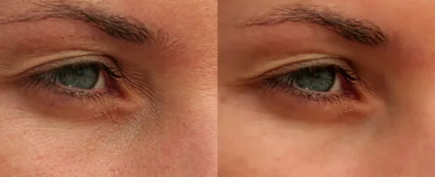 Photoshop: Haut glätten