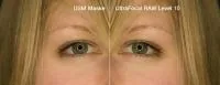 ultrafocal.jpg